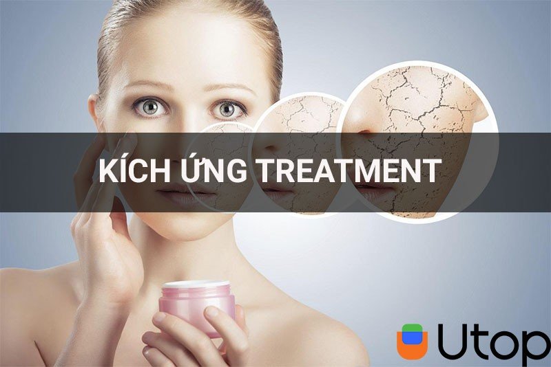 Phải làm gì khi da bị kích ứng với các sản phẩm treatment? Cách khắc phục | Tin Tức | UTOP.VN
