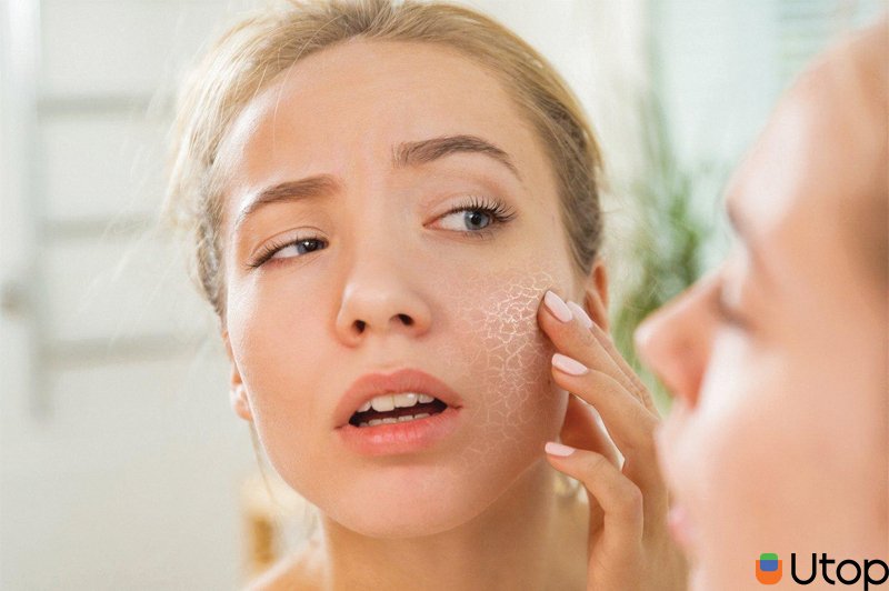 Nếu bạn có làn da nhạy cảm thì nên tránh xa các loại mỹ phẩm có chứa thành phần này