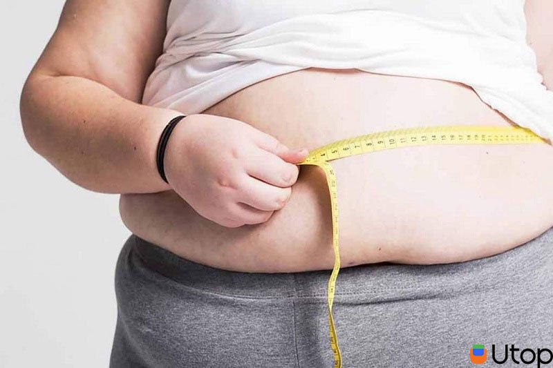 Thừa cân béo phì dẫn đến đột quỵ