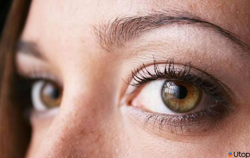 Ngủ đủ giấc, hết thâm quầng mắt?  nguyên nhân là gì?