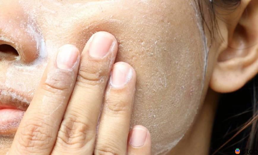 Điều gì gây ra mô mỡ?