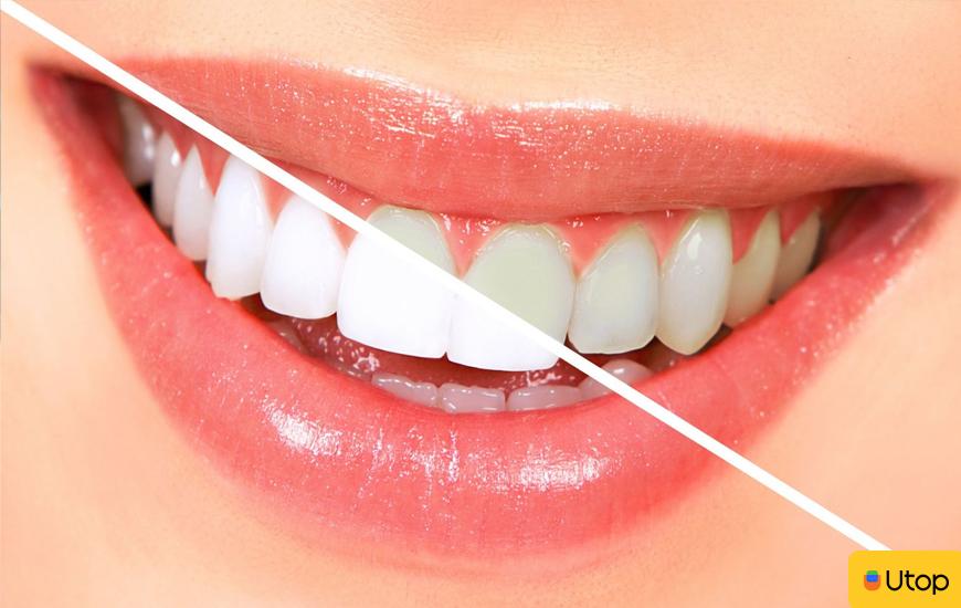 Hướng dẫn cách đánh răng đúng cách để có hàm răng trắng khỏe