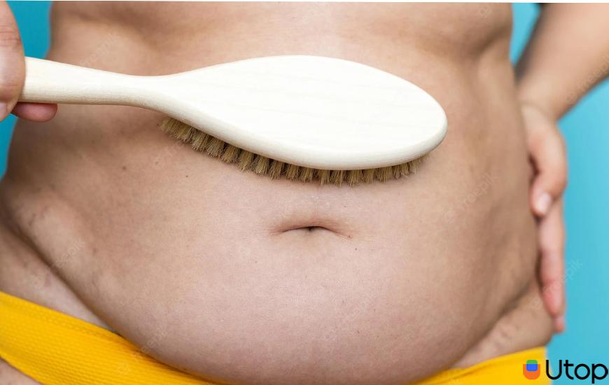 Nhận biết các loại mỡ bụng và cách khắc phục 