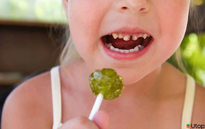 1. Thực phẩm nào gây sâu răng?