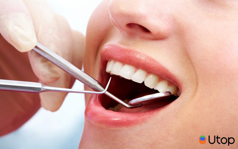 Nhổ răng nào nên niềng?